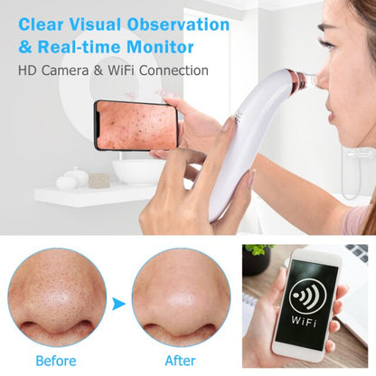 WiFi Blackhead Remover With Built-In Wireless Camera